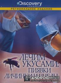 Discovery: Лечим укусами. Пиявки, личинки и пчелы / Leeches, Maggots and Bees: The Bite that Cures