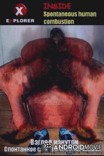 Спонтанное самовозгорание людей / Inside Spontaneous Human Combustion