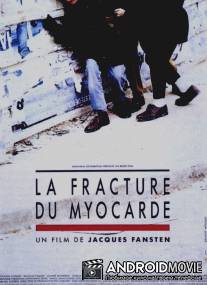 Лечение миокарда / La fracture du myocarde