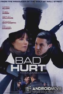 Тяжелое ранение / Bad Hurt