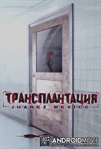 Трансплантация / Juarez, Mexico