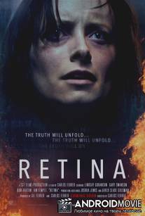 Сетчатка / Retina