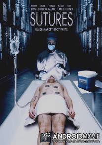 Швы / Sutures